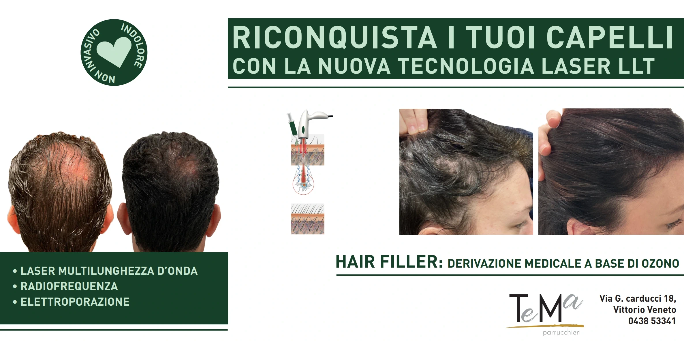 Banner tecnologia laser LLT